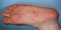 oyster-battlescars-nextday1.jpg (JPEG)
