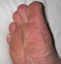 oyster-battlescars1.jpg (JPEG)